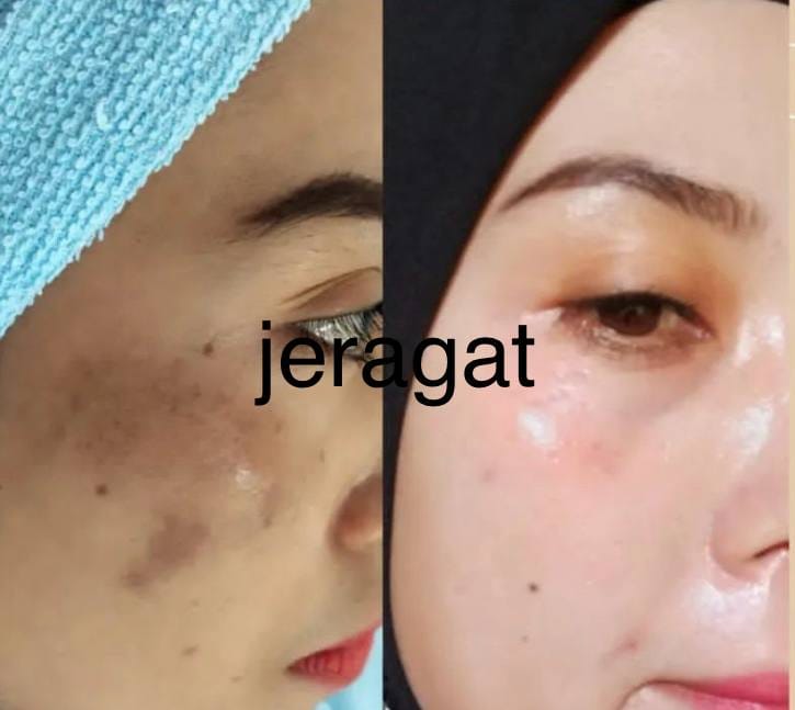 Testimoni